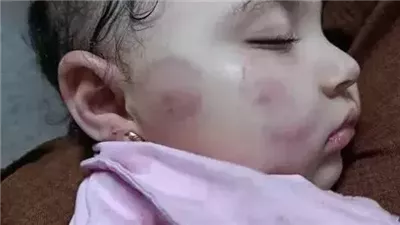 مشكله